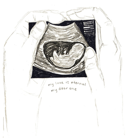 Pencil illustration of Turner syndrome sonogram fetus in a mother's hands