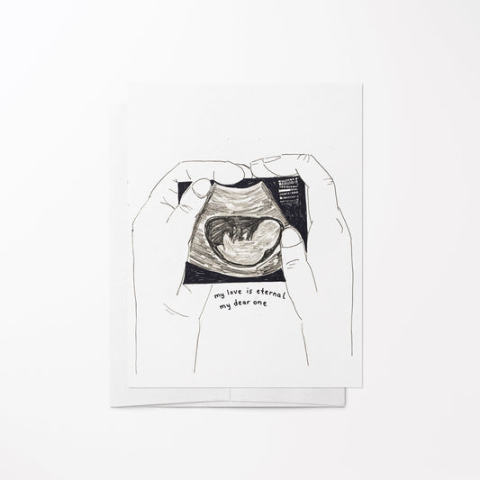 Pregnancy Loss Sow & Tarry Studio